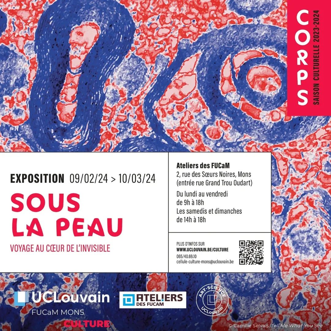 sous la peau